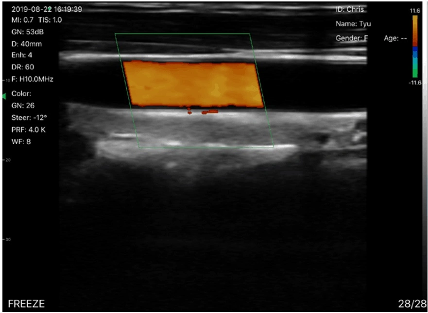 2021 CE Sells Well with 192 Matrix Wireless Ultrasound Probe 3 in 1