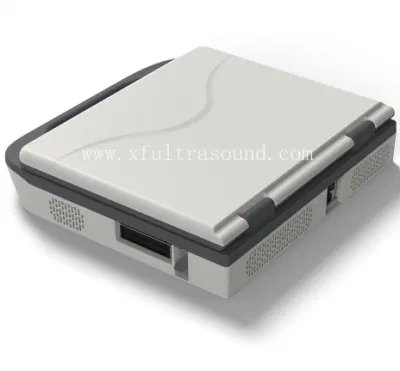 Notebook sistema di diagnosi a ultrasuoni Doppler a colori completamente digitale/portatile Ultrasuoni portatili Xianfeng