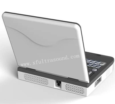 Notebook sistema di diagnosi a ultrasuoni Doppler a colori completamente digitale/portatile Ultrasuoni portatili Xianfeng