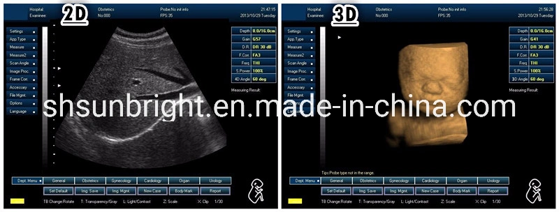 Portable Diagnostic Device Veterinary Multipurpose Ultrasound