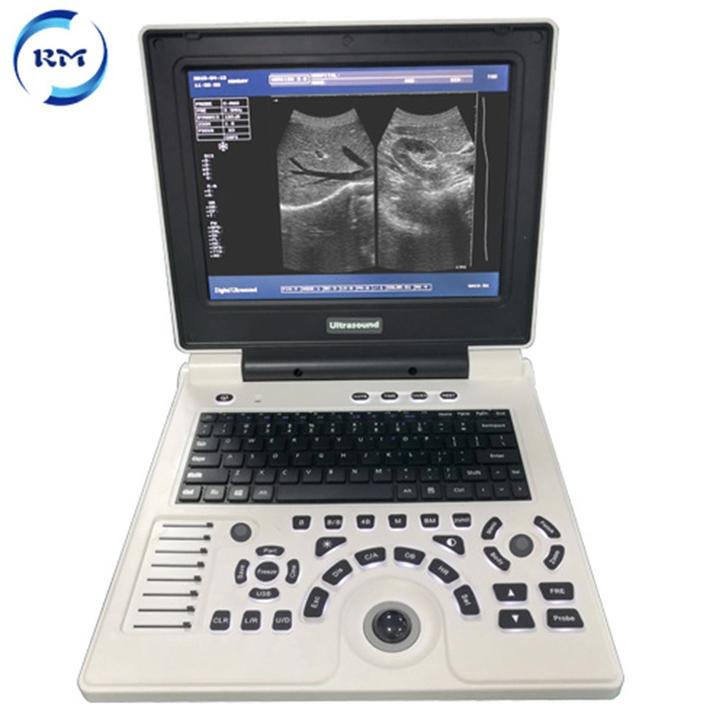High Quality Laptop Ultrasound Scanner B/W Ultrasonic Device for Hospital