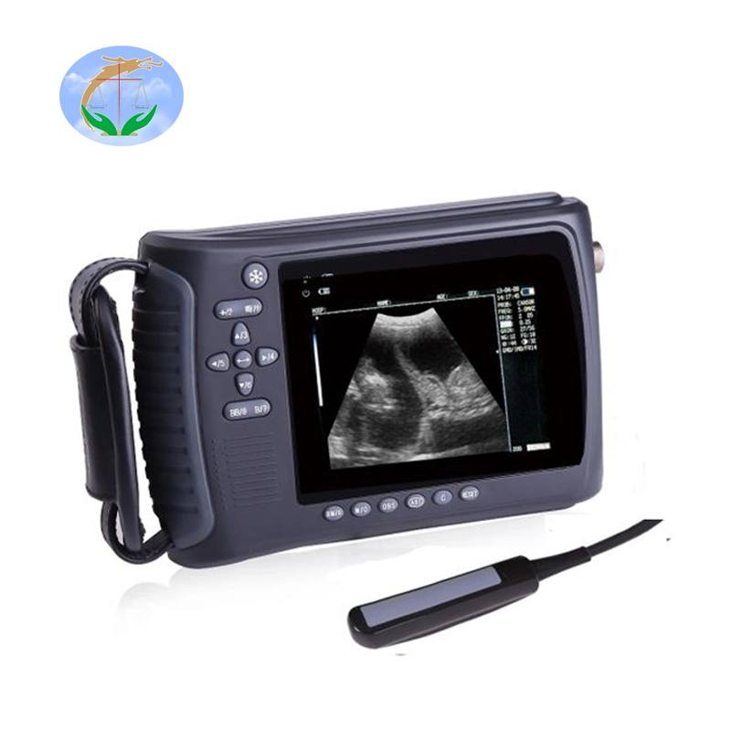 Ultrasound Machine Price Sheep Ultrasound Machine Ultrasound Handheld Device