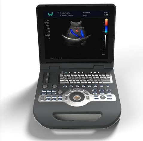 Notebook Full Digital Color Doppler Ultrasound Diagnosis System/ Laptop Portable Handheld Ultrasound Xianfeng