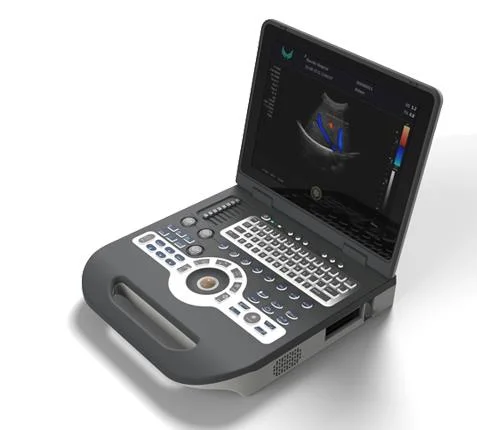 Notebook Full Digital Color Doppler Ultrasound Diagnosis System/ Laptop Portable Handheld Ultrasound Xianfeng