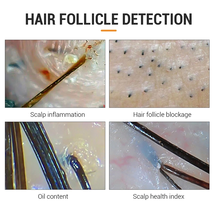Beauty Salon Equipment Skin Analysis Hair Follicle Detection Skin Detector Analyzer Face Machine Facial Scanner Skin and Hair Analysis Machine