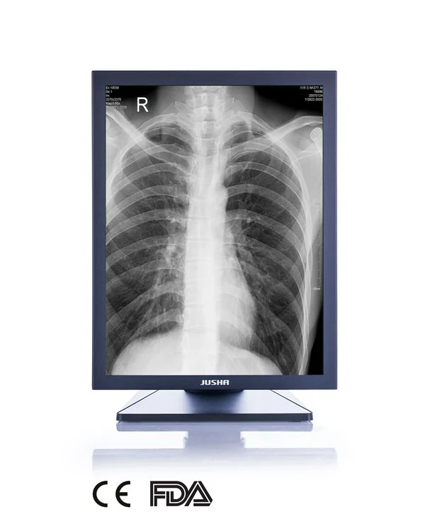 3MP 21-Inch 2048X1536 LED Screen Monochrome Monitor, CE, FDA Approved, Veterinary X Ray Equipment