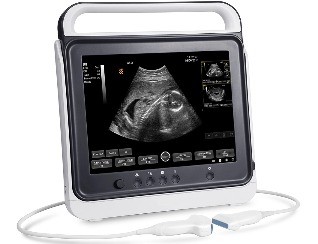 Hospital Clinic Touch Screen B/W Portable Ultrasound Devices with Convex Linear Rectal Probe