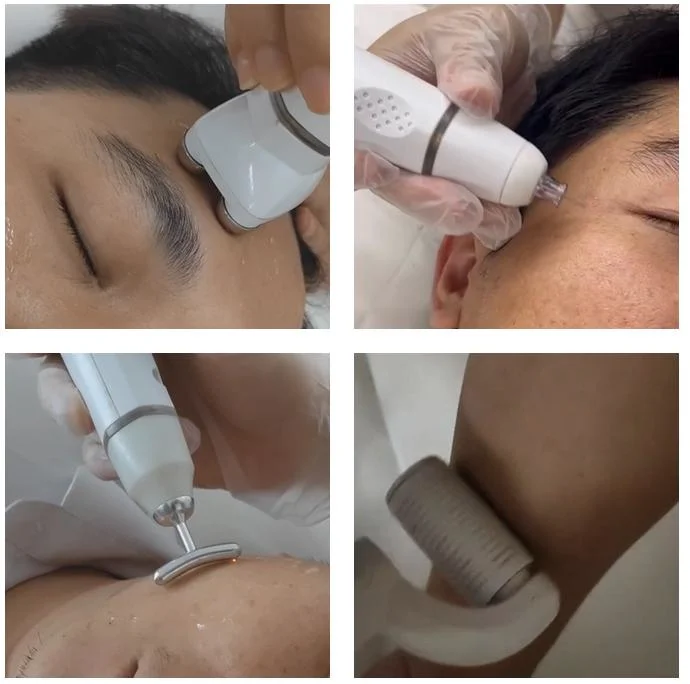 2023 New Fractional Plasm Spot Removal Skin Tightening Face Lift EMS RF Removal Double Chin Device