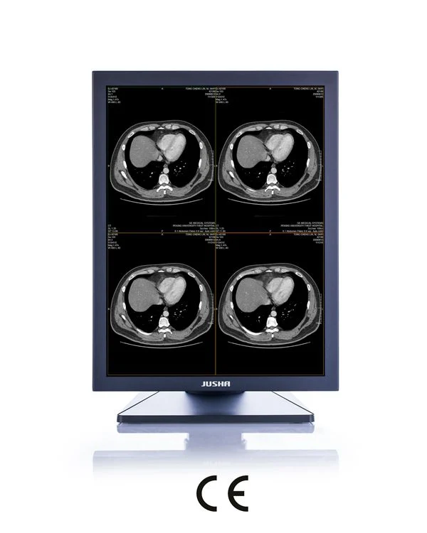 2MP 21-Inch 1600X1200 LED Screen Monochrome Monitor, CE Approved, Angiography Equipment