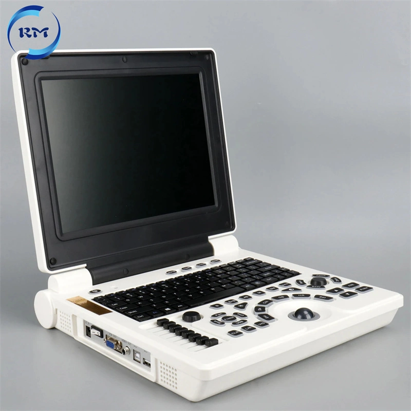 High Quality Laptop Ultrasound Scanner B/W Ultrasonic Device for Hospital