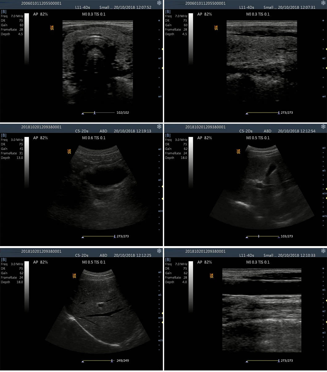 Hospital Clinic Touch Screen B/W Portable Ultrasound Devices with Convex Linear Rectal Probe
