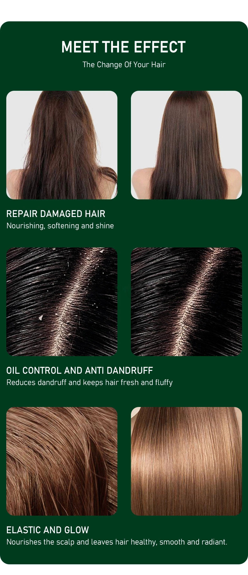 Wholesale Natural Hair Grow Shampoo Hair Loss Organic Ginger Mint Tea Tree Oil Shampoo