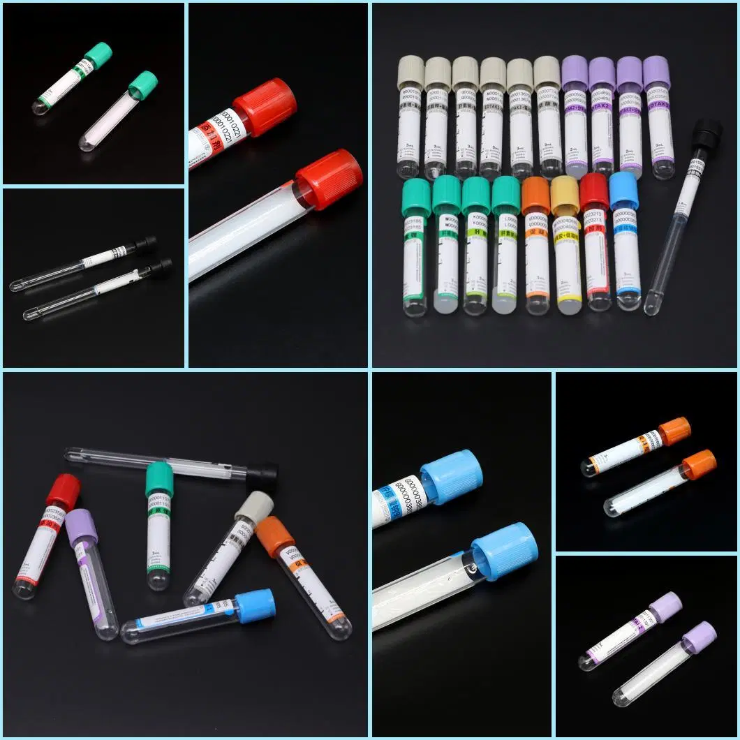 Pet/Glass 2ml~10ml Platelet Rich Plasma Plastic Injection Moulding Medical Supply Vacuum Blood Vessel