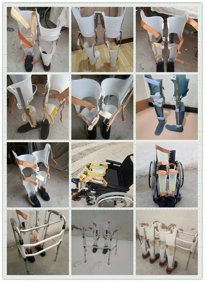 Stainless Steel 19mm Orthotic Knee Prosthetics Orthopedic Lock